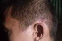Lesmana wartawan korban penganiayaan Sumatra Utara.