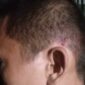 Lesmana wartawan korban penganiayaan Sumatra Utara.