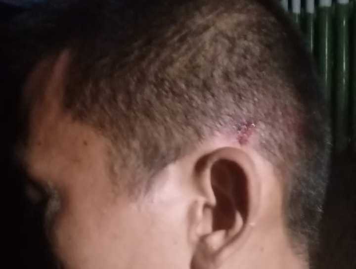 Lesmana wartawan korban penganiayaan Sumatra Utara.