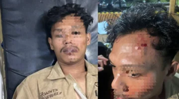 Diduga Jadi Korban Pengeroyokan di Acara Musik Kampus, Mahasiswa Hukum Uniba Laporkan Kasus ke Polisi