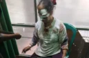 Pemerhati hukum Adit Wahyudin, S.H., resmi mengirimkan somasi kepada pihak IndiHome/Telkom wilayah Kabupaten Lebak. Langkah ini diambil menyusul kecelakaan yang menimpa ibunya di Kampung Grojog,