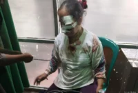 Pemerhati hukum Adit Wahyudin, S.H., resmi mengirimkan somasi kepada pihak IndiHome/Telkom wilayah Kabupaten Lebak. Langkah ini diambil menyusul kecelakaan yang menimpa ibunya di Kampung Grojog,