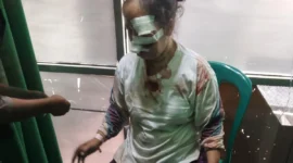 Pemerhati hukum Adit Wahyudin, S.H., resmi mengirimkan somasi kepada pihak IndiHome/Telkom wilayah Kabupaten Lebak. Langkah ini diambil menyusul kecelakaan yang menimpa ibunya di Kampung Grojog,